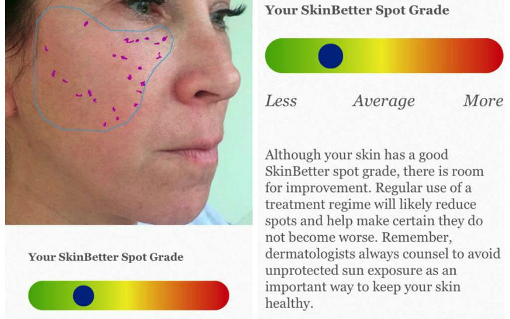 SkinBetter