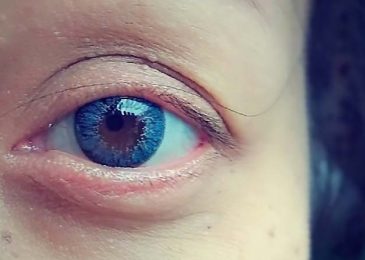 Lensa Kontak Akan Bisa Zoom Di Masa Mendatang