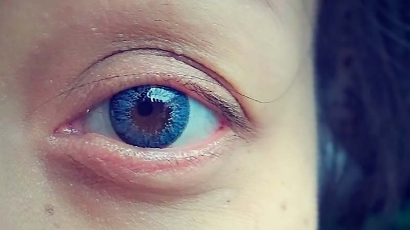 Lensa Kontak Akan Bisa Zoom Di Masa Mendatang